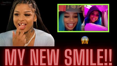 chrisean teeth|Chrisean Rock Shares New Video Of Her Smile After